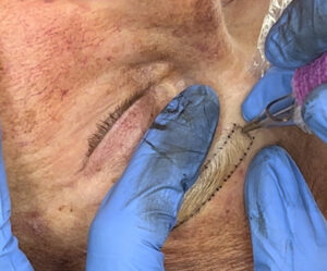 brow tattoo on woman